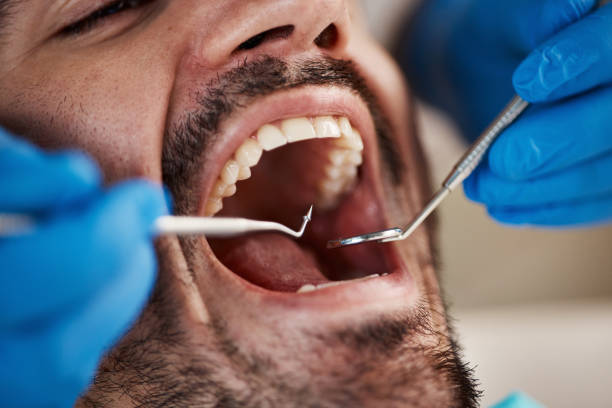 Best Emergency Broken Tooth Repair in Sebring, OH